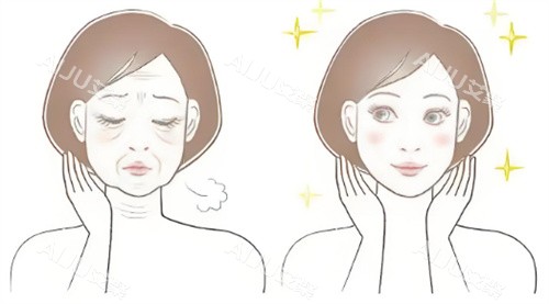 脸部抗衰前后对比