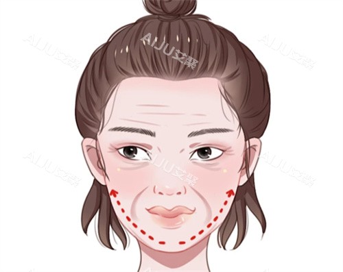 面部抗衰提升卡通图