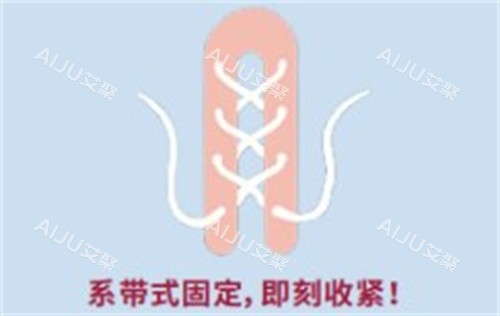 再生阴道紧缩术