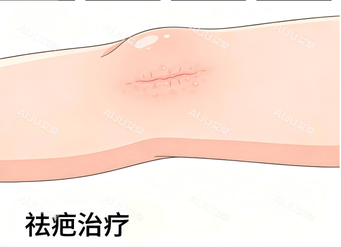 疤痕治疗动画示意图 疤痕治疗动画示意图